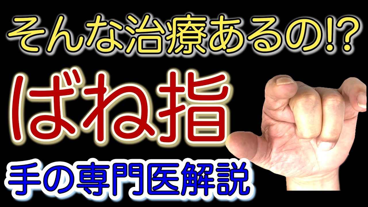 【手専門医解説】ばね指　イラスト付き