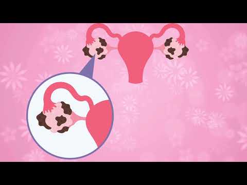 Common Female Reproductive Disorders and How They Are Diagnosed