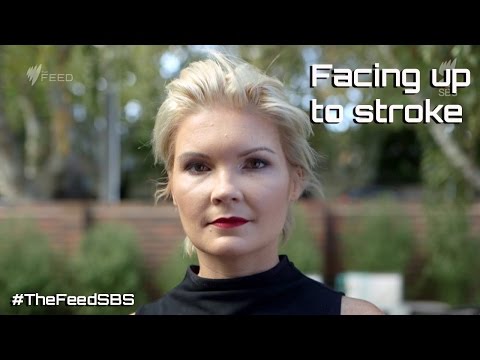Facing up to stroke - The Feed