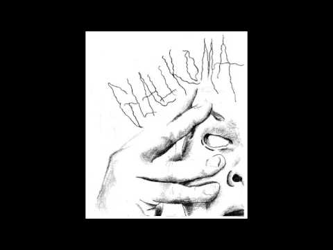Glaukoma - Rotina