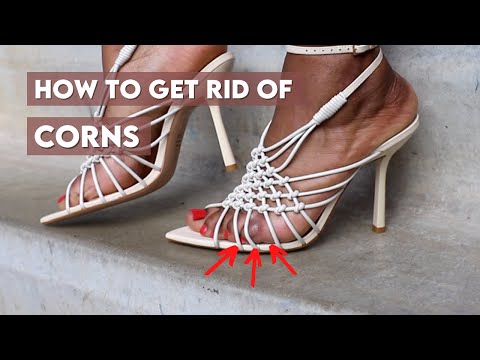 How to Safely Remove a Foot Corn at Home