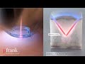 The MIRIA Skin Tightening Treatment At PFRANKMD By Dr Paul Jarrod Frank 𝐇𝐨𝐰 𝐃𝐨𝐞�