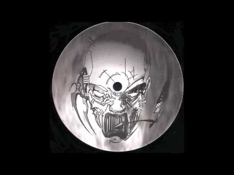 [BLOC 46-003] Aphasia - B1 - Melody 0088