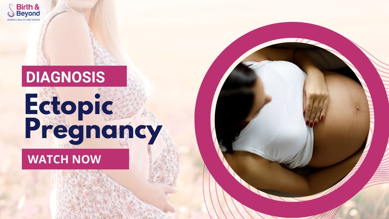 Diagnosis of Ectopic Pregnancy