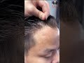 Most Premium Hair Patch Natural Looking Patch