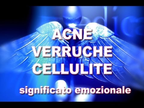 Quello che è la psoriasi e il rosa privano Psoriasi principale - medicina tradizionale
