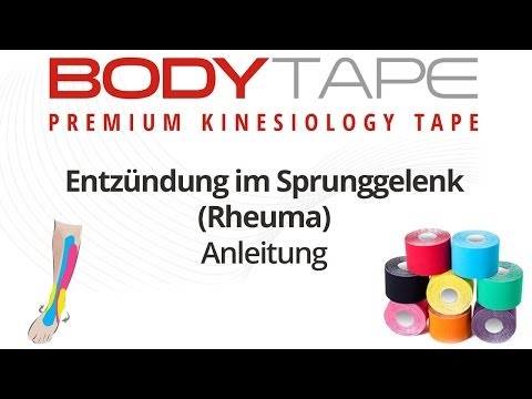 Osteochondrose kann im Herzen stechen Schmerzen im unteren Rücken Schwangerschaft