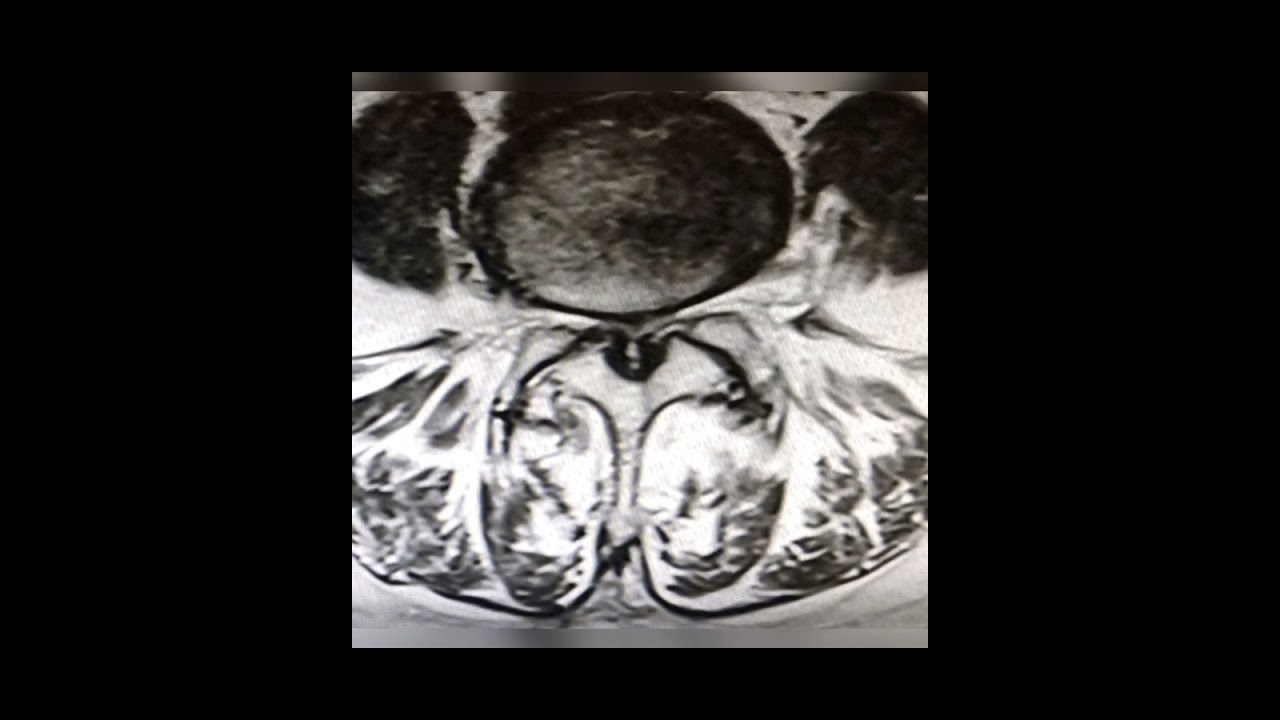 Marco Aurélio Severo Da Silva Versiani-73