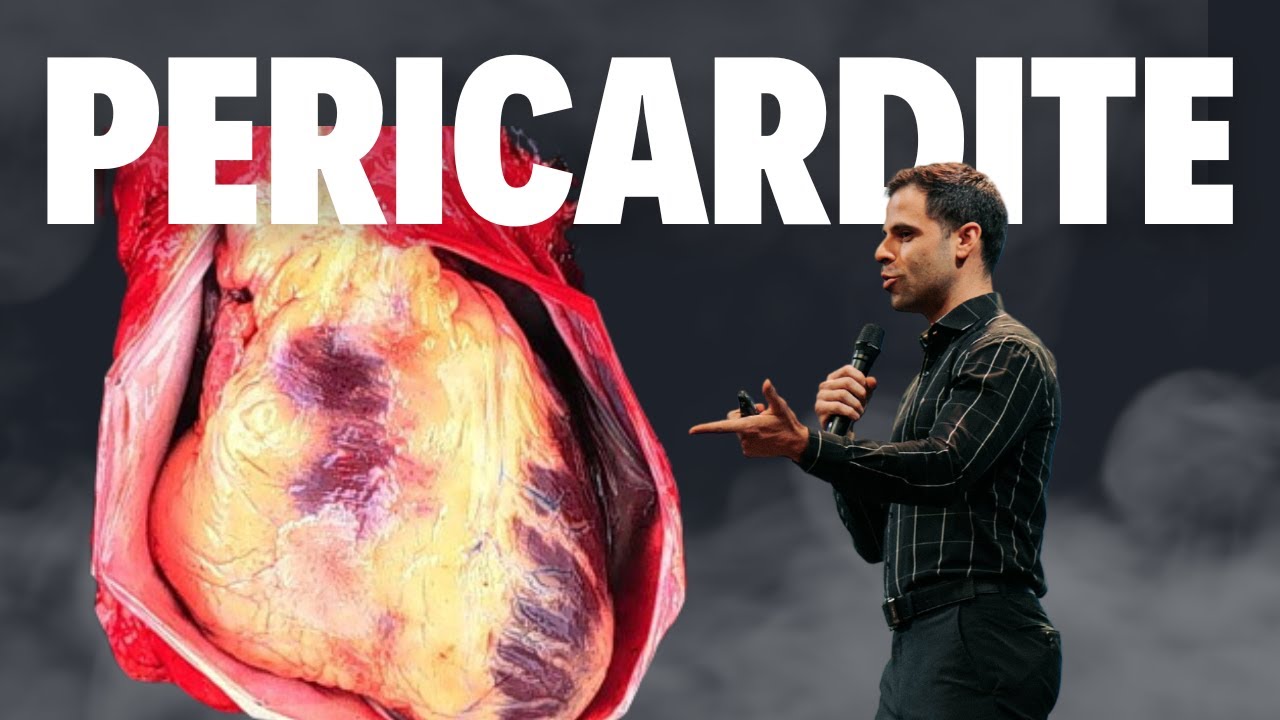 Pericardite