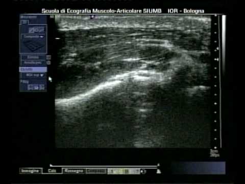 Di mal di schiena va in su Mal di collo alla base del cranio