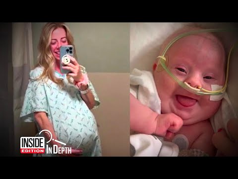 Mom Says No to Termination After Son’s Down Syndrome Diagnosis