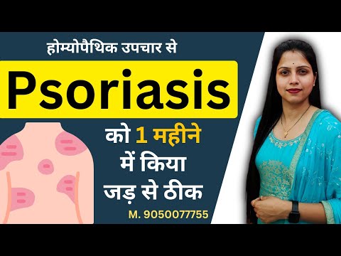  psoriasis