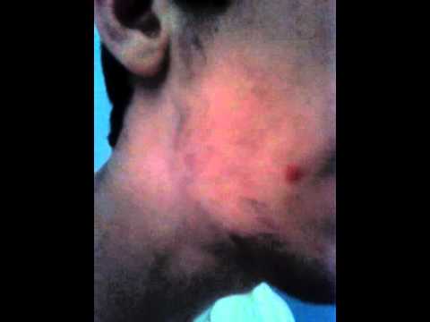 Robert Barrett practice