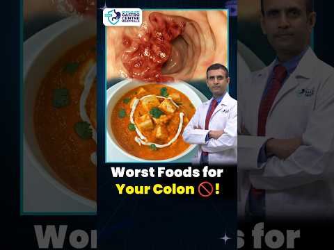 Stop Eating These! Foods Secretly Harming Your Colon 😱 #shorts