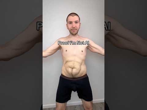 How Much Loose Skin Do I Have?