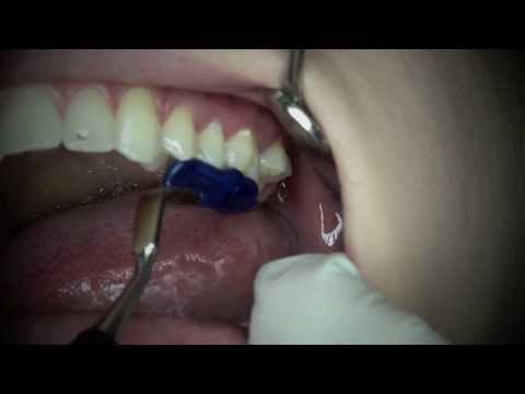 ZemFix® - The innovative cementing - Trailer [Full HD]