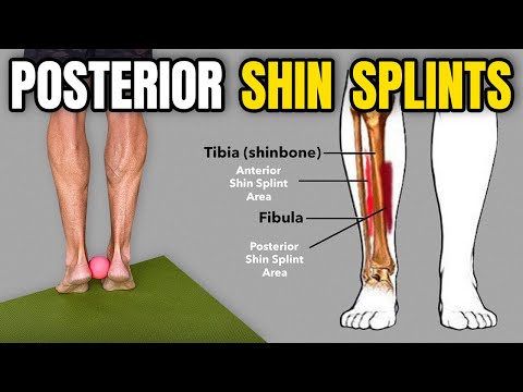 3 Rehab Exercises for Posterior Shin Splints