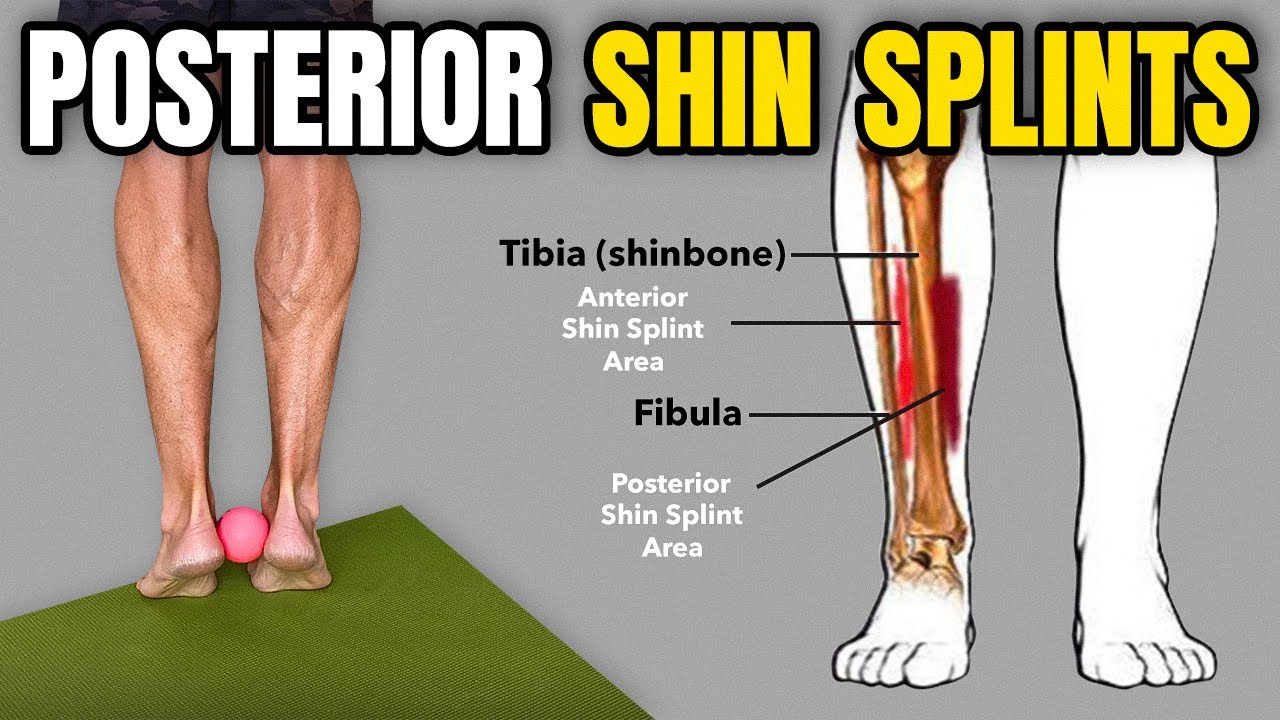 3 Rehab Exercises for Posterior Shin Splints