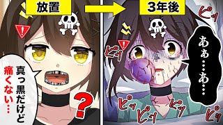 虫歯を放置するとどうなるのか？【アニメ】【漫画動画】