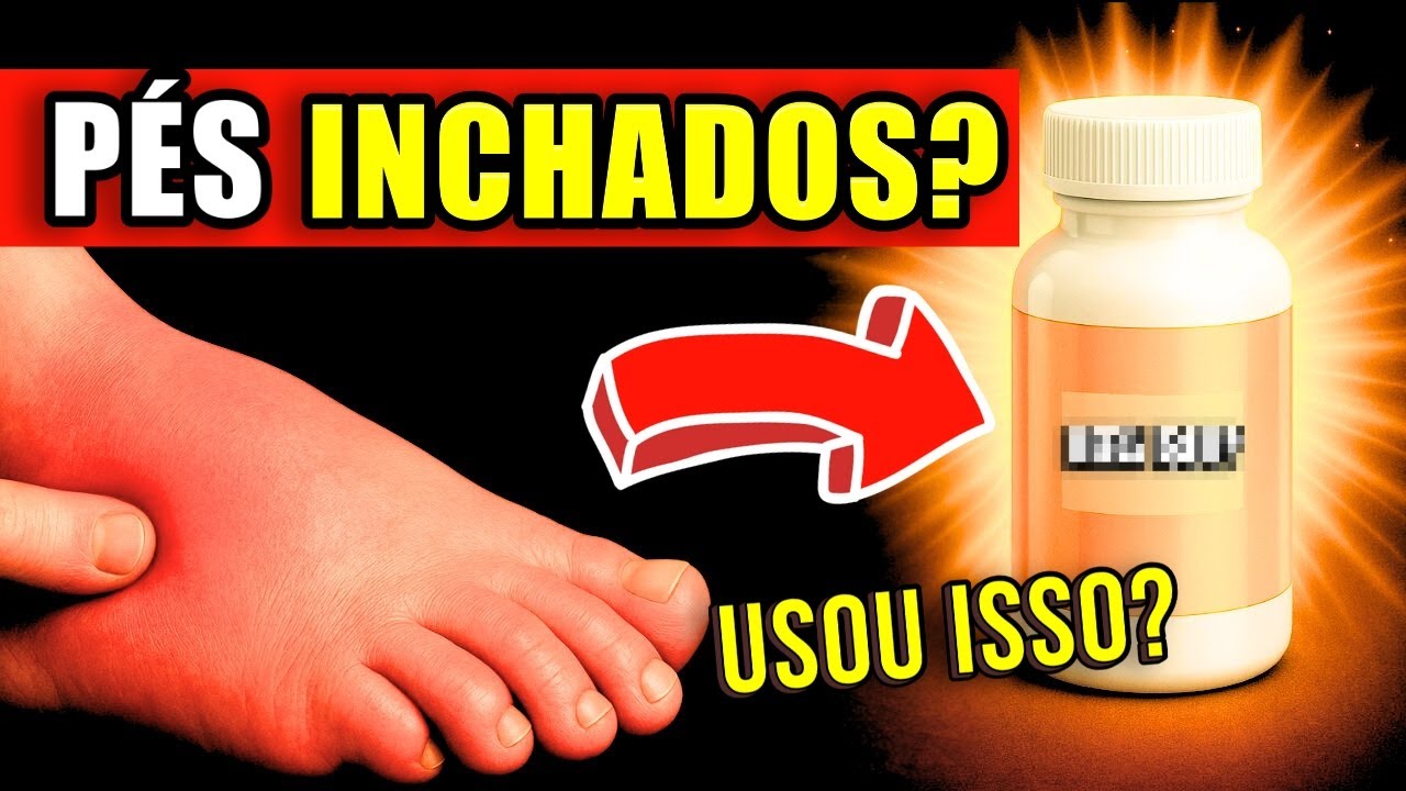 Swollen Legs? The FATAL Mistake You're Making (and How to Fix It NOW!)