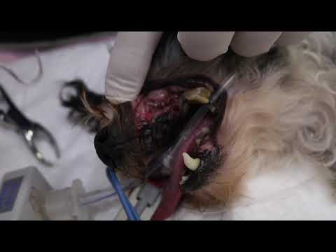 Dr Mike performs full mouth teeth extractions