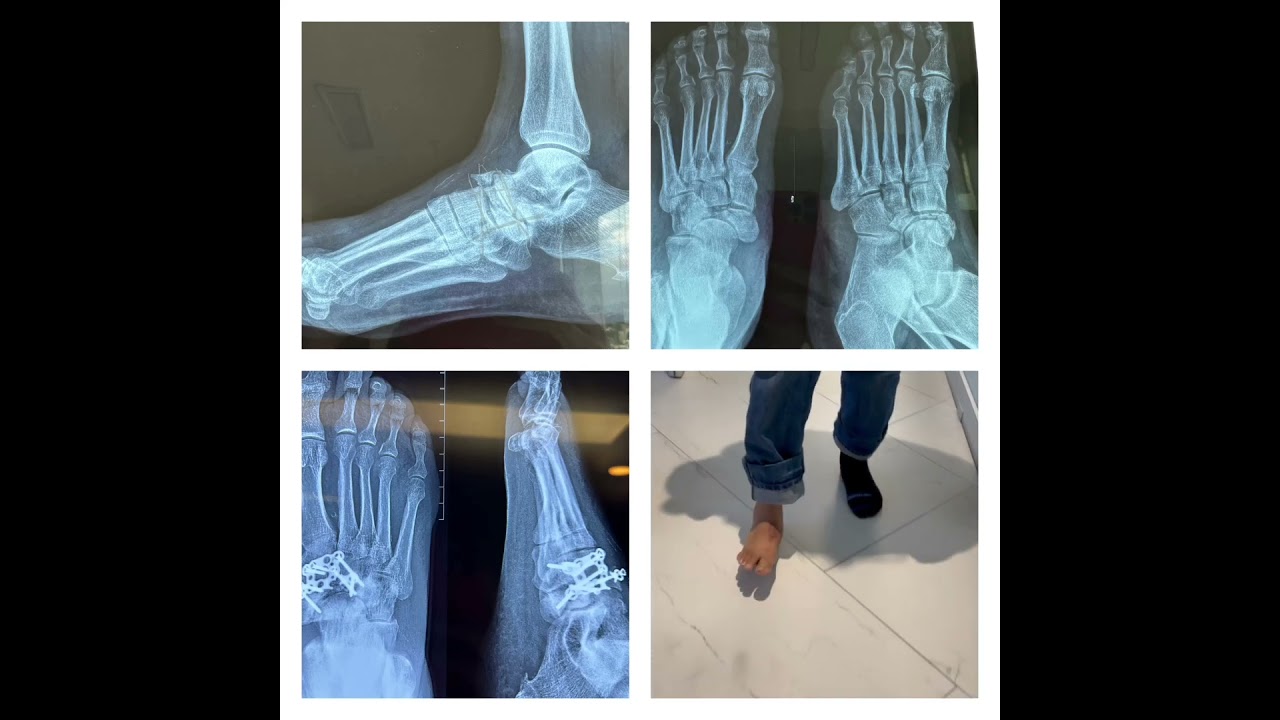 Diego Gomez Orozco-10