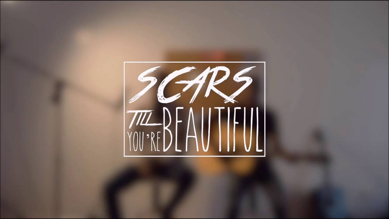 Download Alessia Cara Scars To Your Beautiful Mp3 Download Mp4 3gp Hd Naijagreenmovies Fzmovies Netnaija