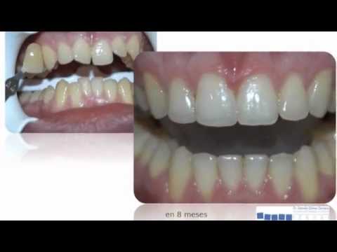 Video Clinica Dental Dr. German Gomez