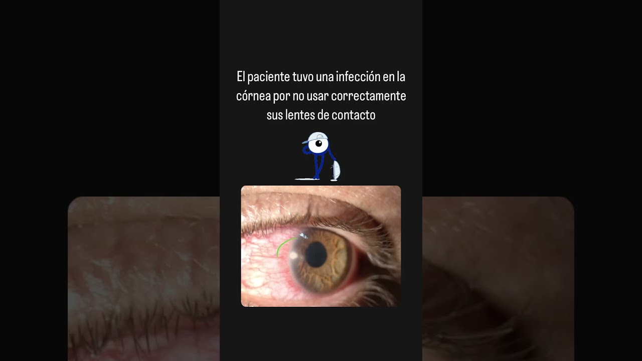 Kristell G Cantón Alonso-6