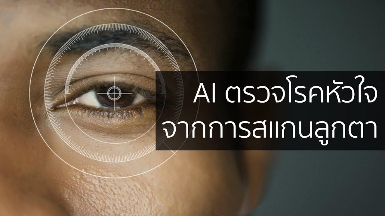 Google พัฒนาระบบ AI ตรวจพบความเสี่ยงในการเกิดโรคหัวใจได้จากการสแกนลูกตา | Droidsans