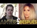 Khloe Kardashian | Transformación Antes y Después | Cirugías Estéticas Khloe Kardashian | Transformación Antes y Después | Cirugías Estéticas