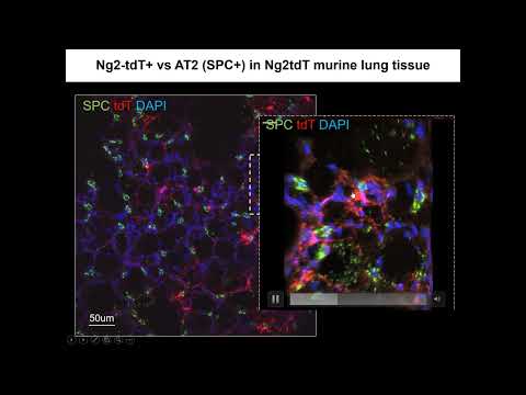 A sinalização de células murais SDF1 está associada à patogênese da hipertensão arterial pulmonar