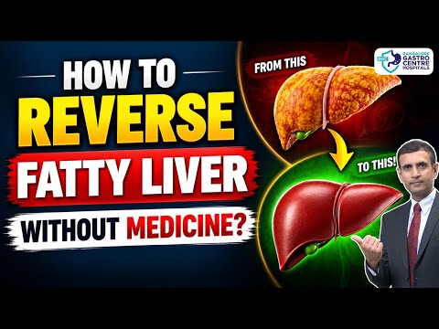 Reverse Fatty Liver Without Medicine! | Fatty Liver Cure Explained by Gastroenterologist