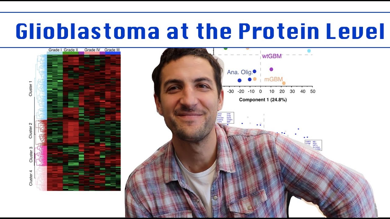 Glioblastoma at the Protein Level