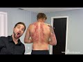 Ahh His Back Major Toxic Release In Back And Arm Of Tall Florida Man After Scraping And Crunches