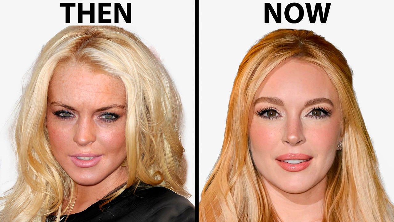Lindsay Lohan's NEW FACE | Plastic Surgery Analysis