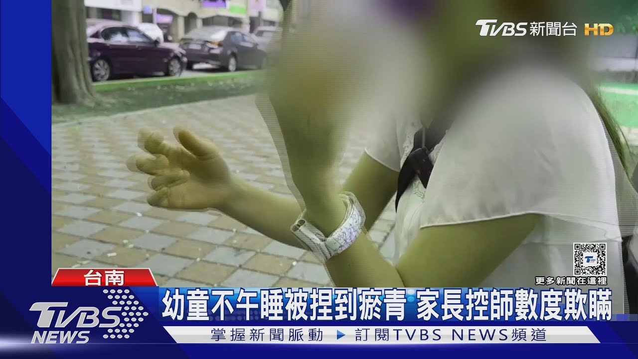 幼童滑步車摔到瘀青? 家長調電眼戳謊:老師捏的