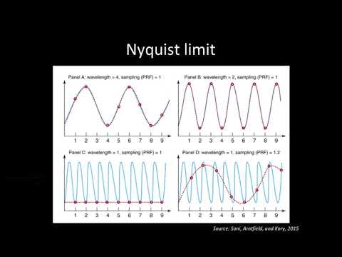 Principles of Doppler Ultrasound