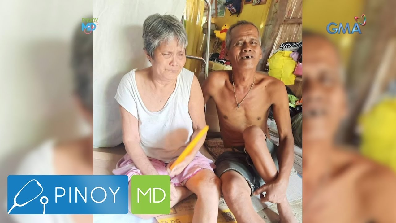 Pinoy MD: Polio virus, paano ba maiiwasan