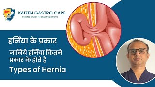 Types of Hernia: Kaizen Gastro Care