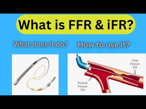 What is FFR 0r iFR? How does it work?