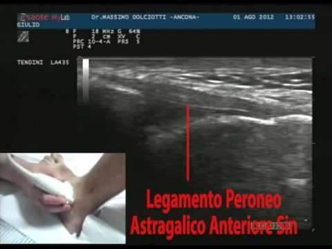 Mal di schiena ginnastica basse ernia del disco lombare Artropatia e osteocondrosi