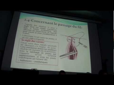 comment soigner point de suture