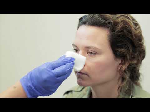 How to stop a nose bleed