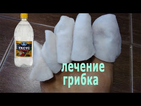 Wie gribok auf dem Finger des Beines übergeben wird Die Salbe für die Männer von gribka auf dem Glied
