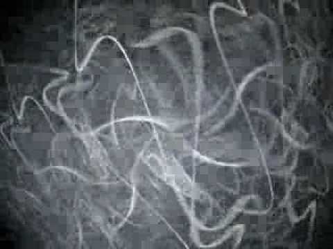 Azax Syndrome vs Tube My November