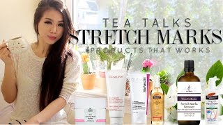 TeaTalk| Stretchmarks