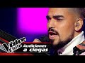 Paulo Zieballe Herida Audiciones A Ciegas The Voice Chile