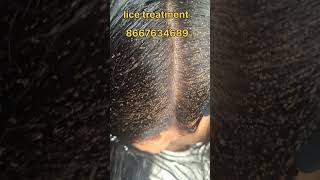 How to remove nits and lice #nits #lice #headliceremoval #hairlice #haircare #peenu #eeru #coimbator