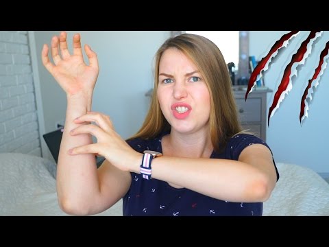 Артрит нижнечелюстного сустава лечение форум Орлетт ортез на коленный сустав hks 303